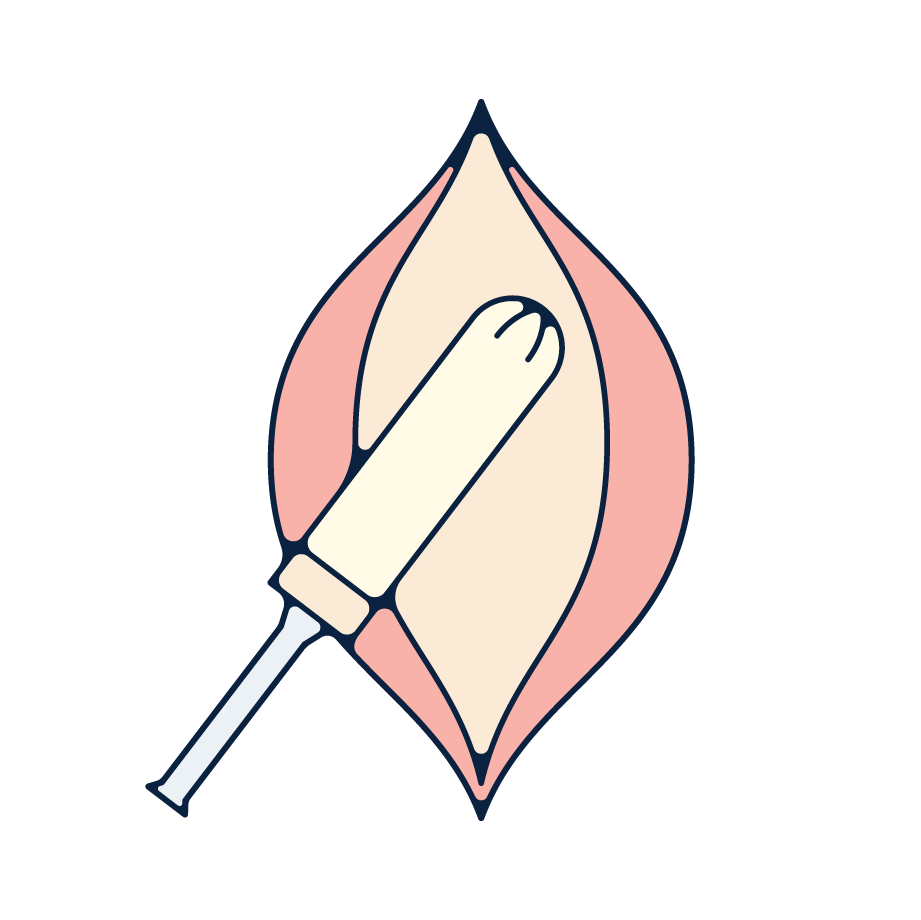 Why is My Tampon Leaking?